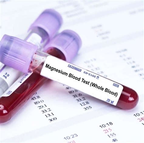 magnesium blood test bottle|blood test for low magnesium.